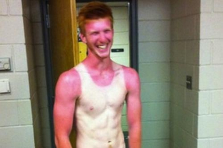 The 24 Most Awkward Tan Lines This Summer