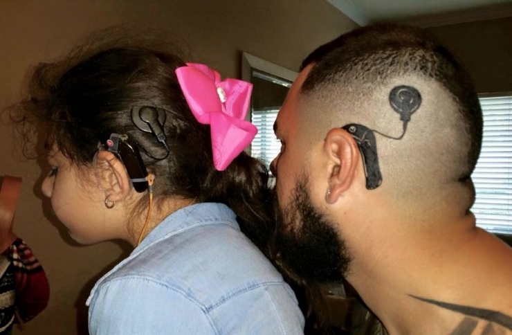 Illustration de l'article : His daughter didn’t want to wear a hearing aid because it made her feel different... What her father did is amazing!