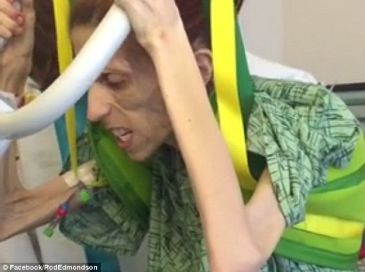 Illustration de l'article : In danger of dying at a weight of just 44 pounds, she takes control and it's impressive to see what she has become...