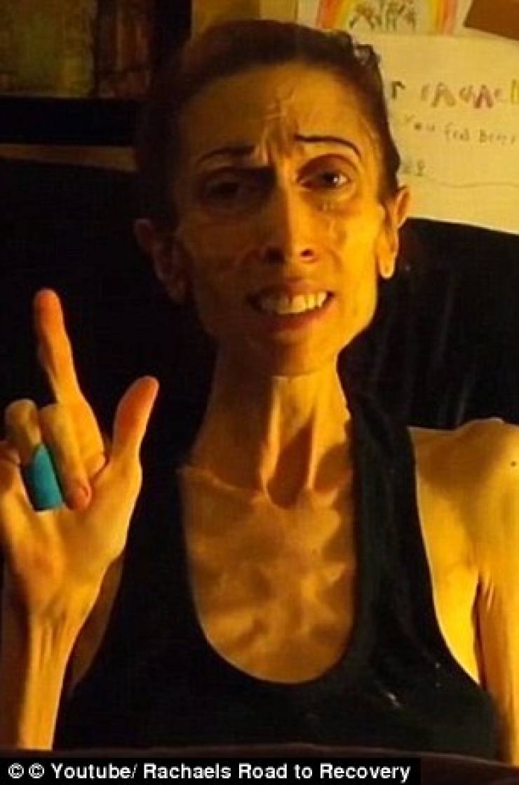 Illustration de l'article : In danger of dying at a weight of just 44 pounds, she takes control and it's impressive to see what she has become...