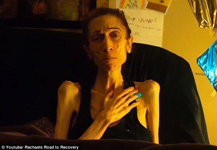 Illustration de l'article : In danger of dying at a weight of just 44 pounds, she takes control and it's impressive to see what she has become...