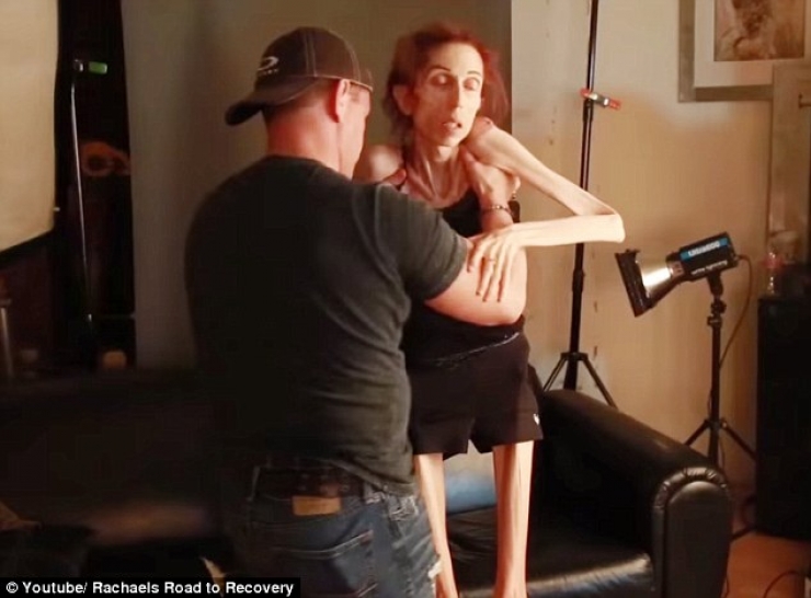 Illustration de l'article : In danger of dying at a weight of just 44 pounds, she takes control and it's impressive to see what she has become...