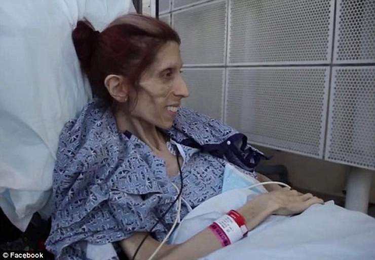 Illustration de l'article : In danger of dying at a weight of just 44 pounds, she takes control and it's impressive to see what she has become...