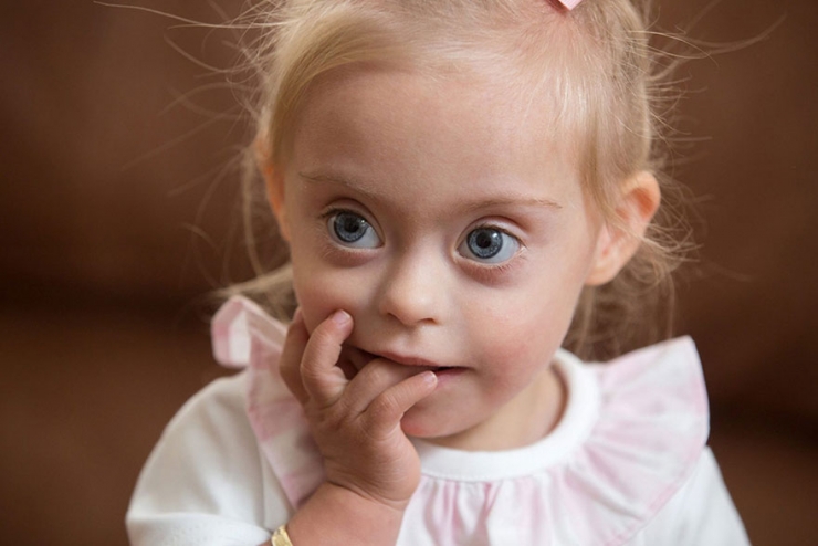 Illustration de l'article : At just two years old, ad agencies are fighting over this princess with Down's syndrome...