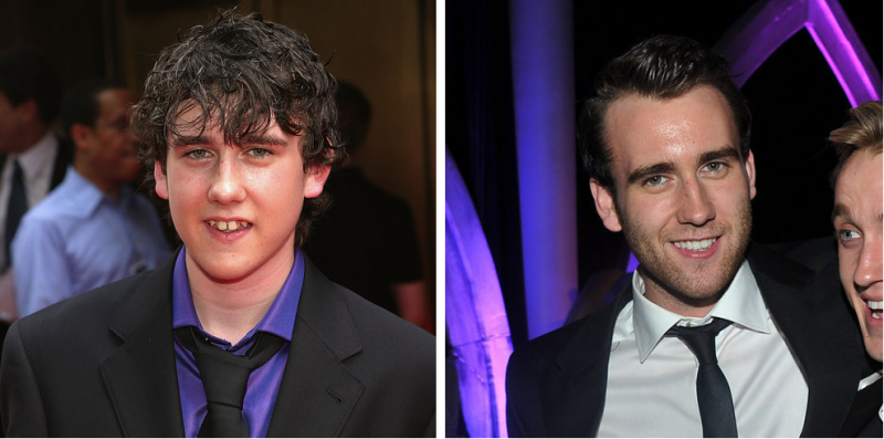 Illustration de l'article : 16 photos that show the most impressive celebrity transformations