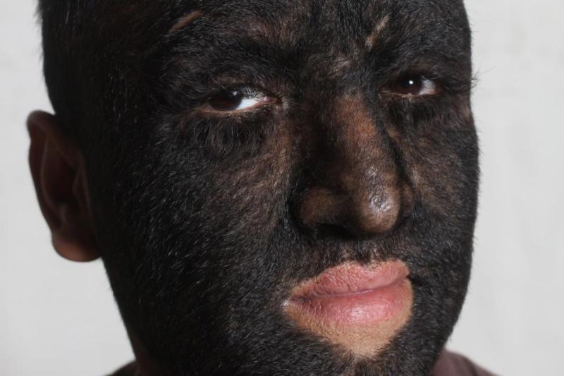 Illustration de l'article : 9 people who have really unusual body characteristics!