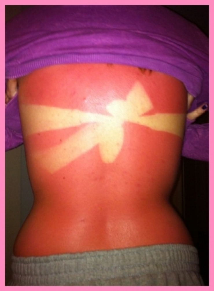 Illustration de l'article : These 22 people should’ve had to take a class before wanting a tan...