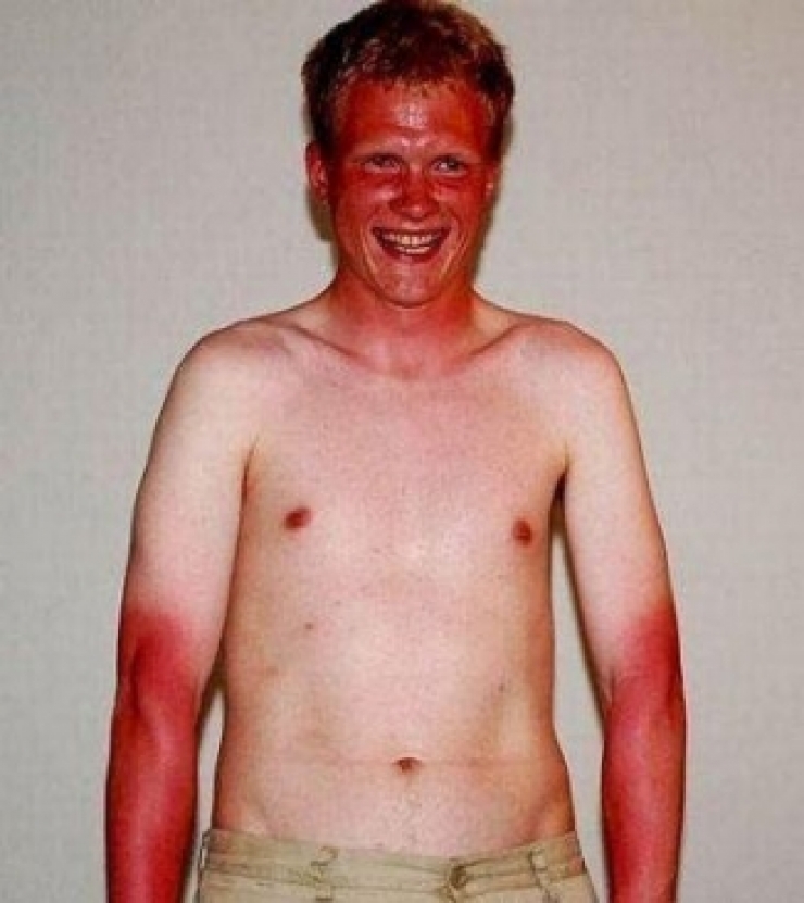 Illustration de l'article : These 22 people should’ve had to take a class before wanting a tan...