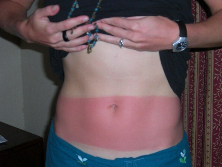 Illustration de l'article : These 22 people should’ve had to take a class before wanting a tan...