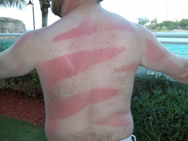 Illustration de l'article : These 22 people should’ve had to take a class before wanting a tan...