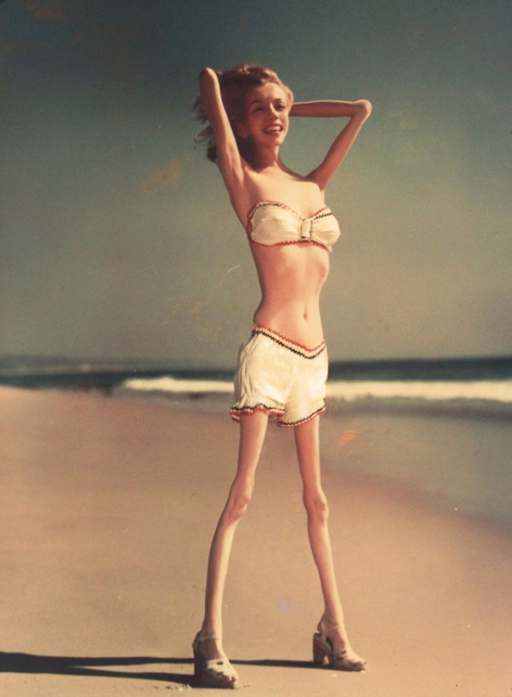 Illustration de l'article : Celebrities are Photoshopped to educate readers about anorexia!