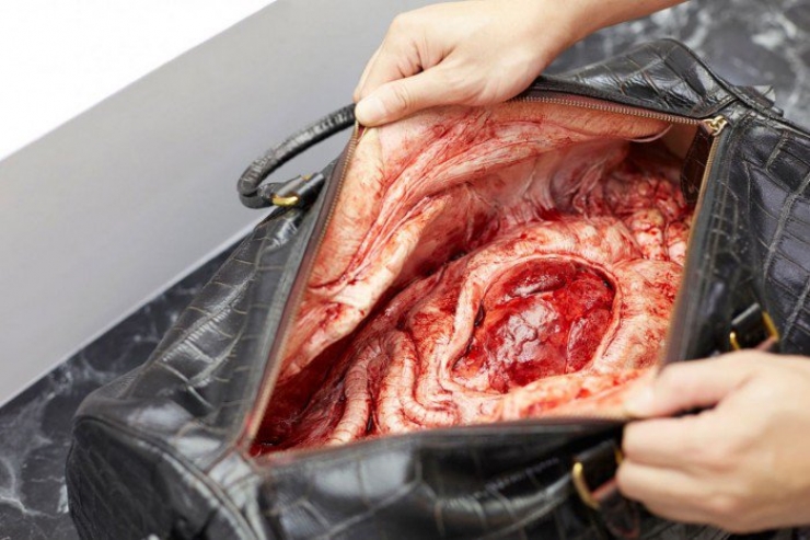 Illustration de l'article : Don’t buy this type of luxury bags anymore! You can no longer deny the truth behind them. It’s terrible…