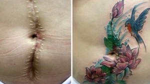 Illustration : "She offers free tattoos to cover up the scars from these big life injuries"