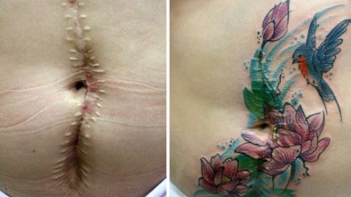 Illustration : "She offers free tattoos to cover up the scars from these big life injuries"