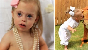 Illustration : "At just two years old, ad agencies are fighting over this princess with Down's syndrome..."