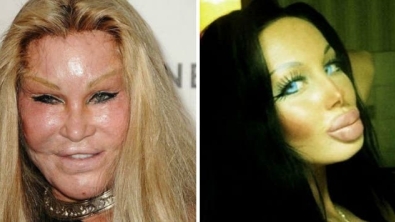 Illustration : 15 completely failed cosmetic surgeries