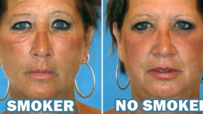 Illustration : "Smokers vs. Non-smokers... These 8 pictures of twins show us that the difference is obvious!"