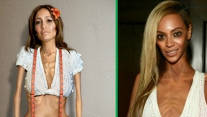 Illustration : "Celebrities are Photoshopped to educate readers about anorexia!"