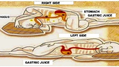 Illustration : "You absolutely have to sleep on the left side of your body! Here's why:"