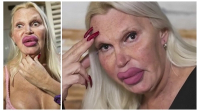 Illustration : This woman has spent $76,000 to achieve the perfect look... What do you think, after seeing her before pictures?