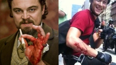 Illustration : "14 actors who suffered injuries during filming"