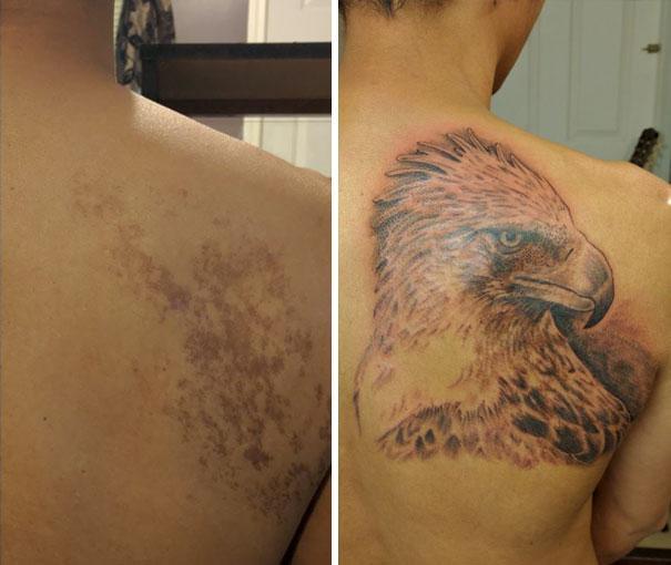 Illustration de l'article : 14 tattoos that turned a birthmark into a work of art