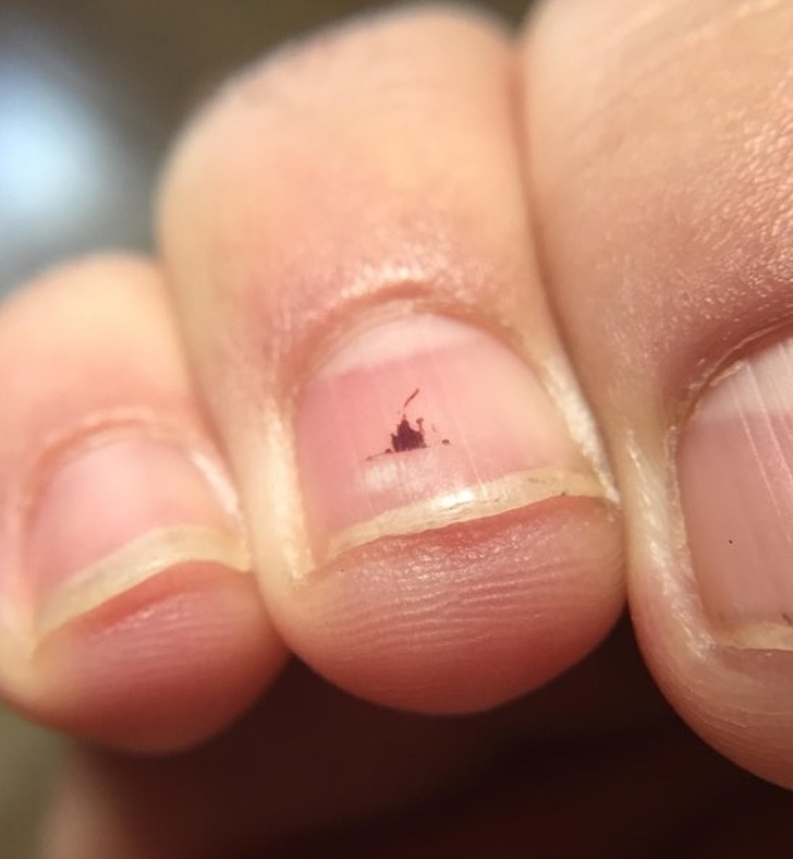 Illustration de l'article : 23 unsettling photos that require a closer look!