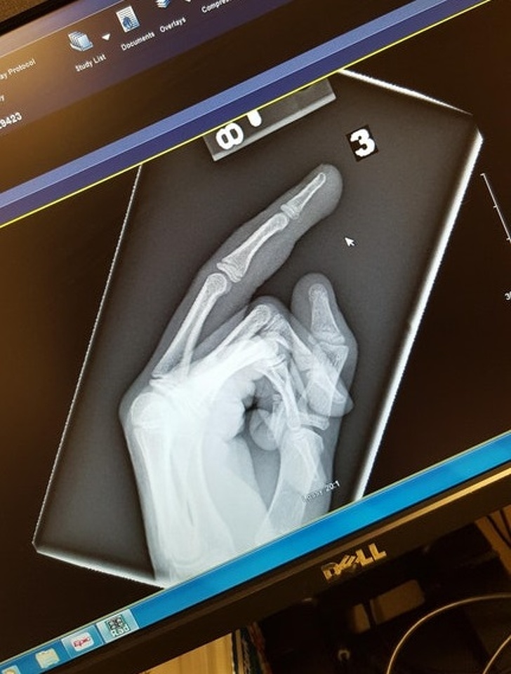 Illustration de l'article : 14 people who immortalized their terrible day